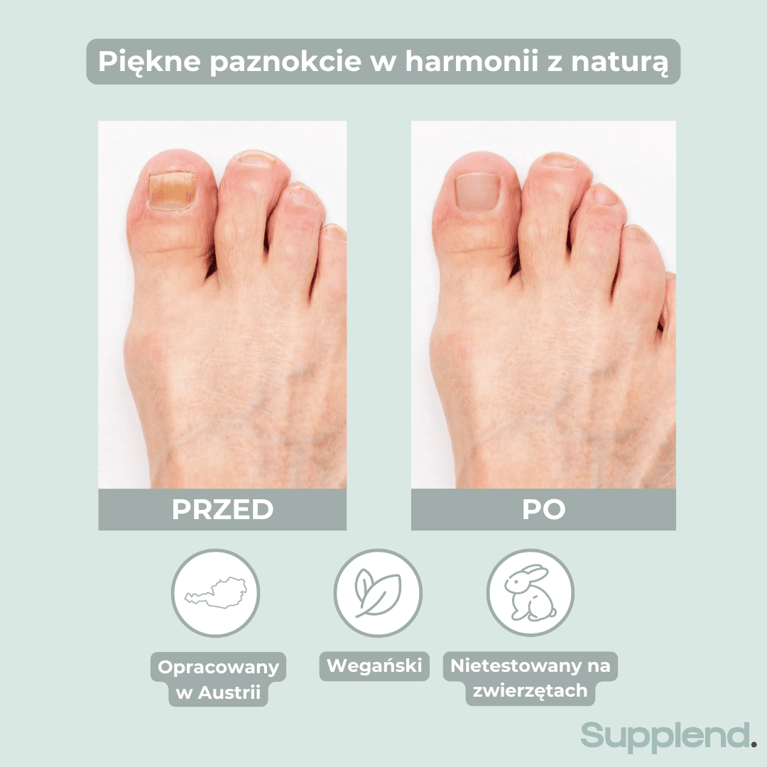 Długopis do paznokci